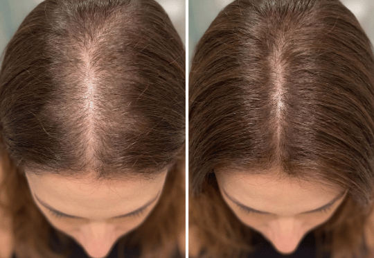 Transformação com Soliv